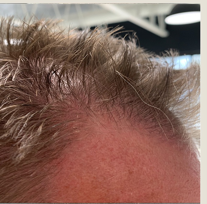 James before treatment