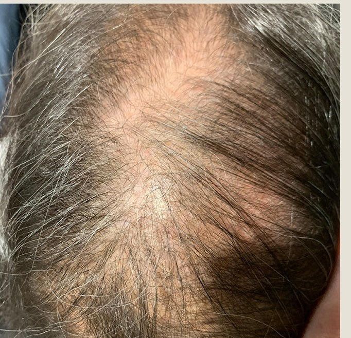 Susie before treatment