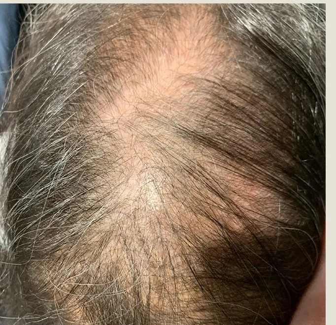 Susie before treatment