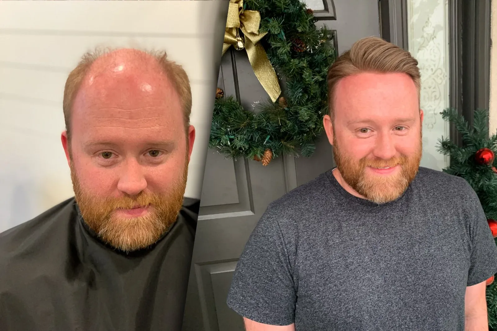 Hair piece before and after transformation