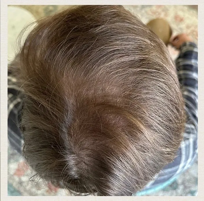 After 6 Months of treatment