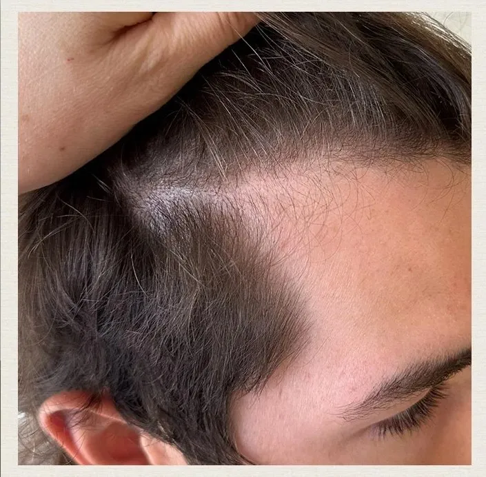 After 6 Months of treatment