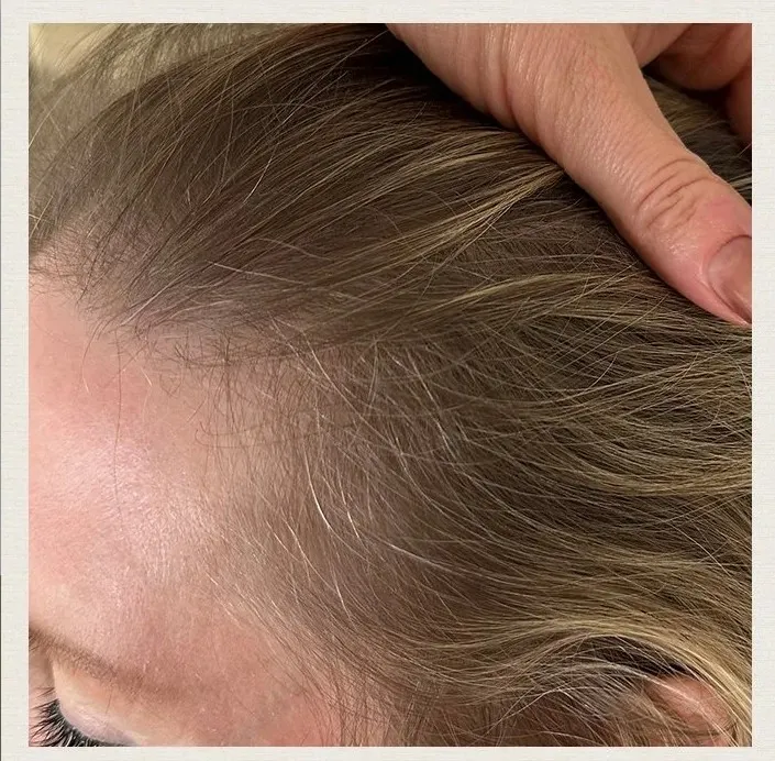 After 6 Months of treatment