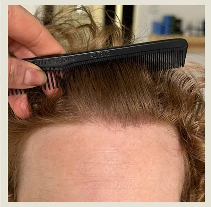 After 6 Months of treatment