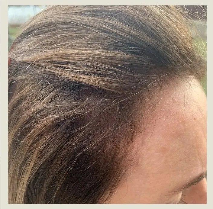 After 8 Months of treatment