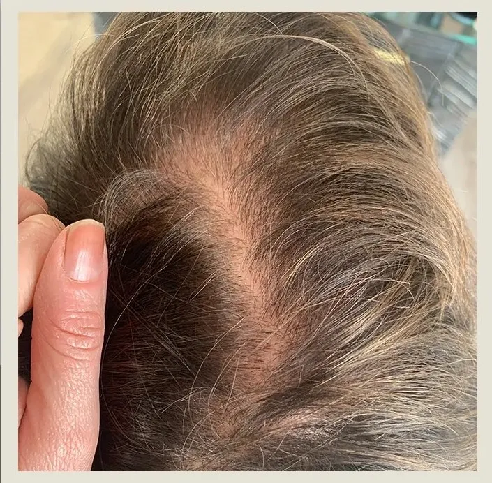 After 6 Months of treatment