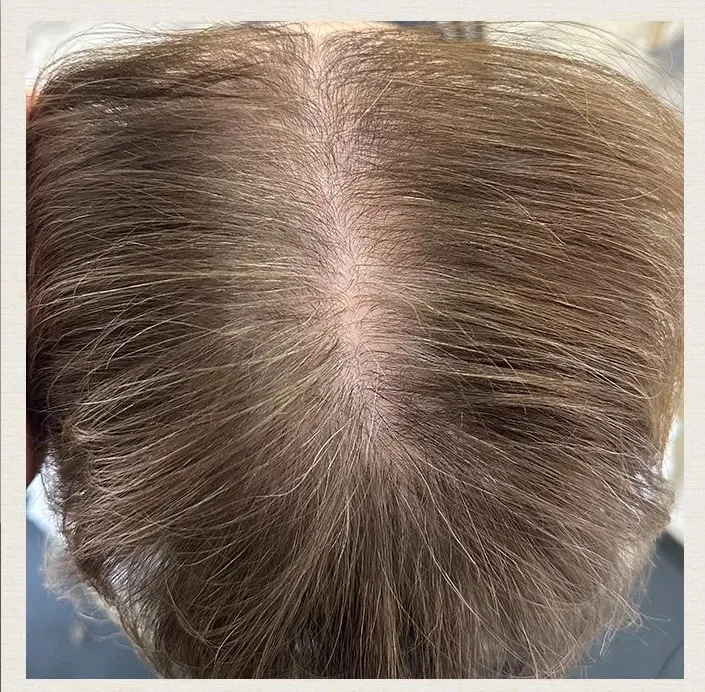 After 6 Months of treatment