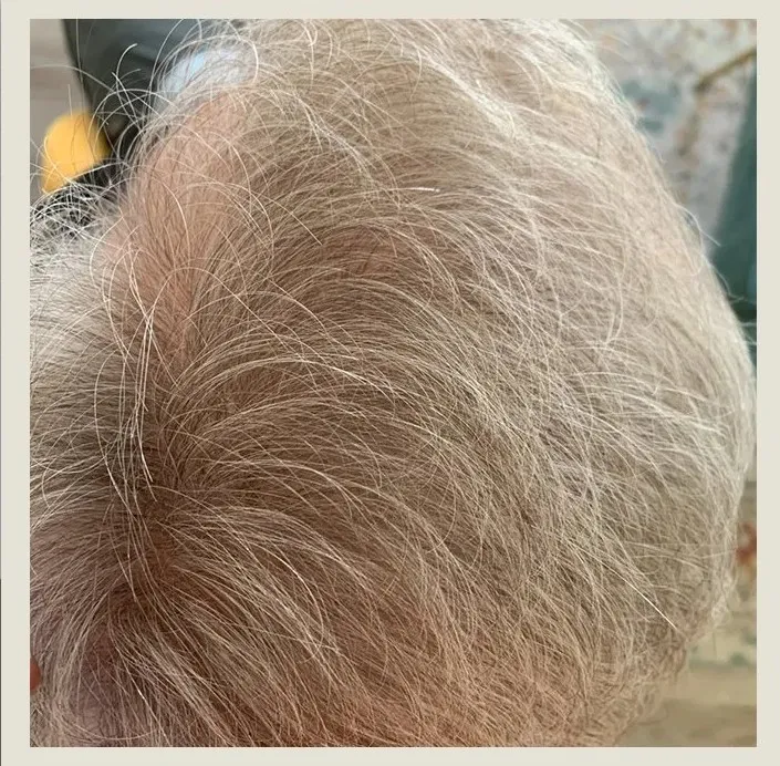 After 8 Months of treatment