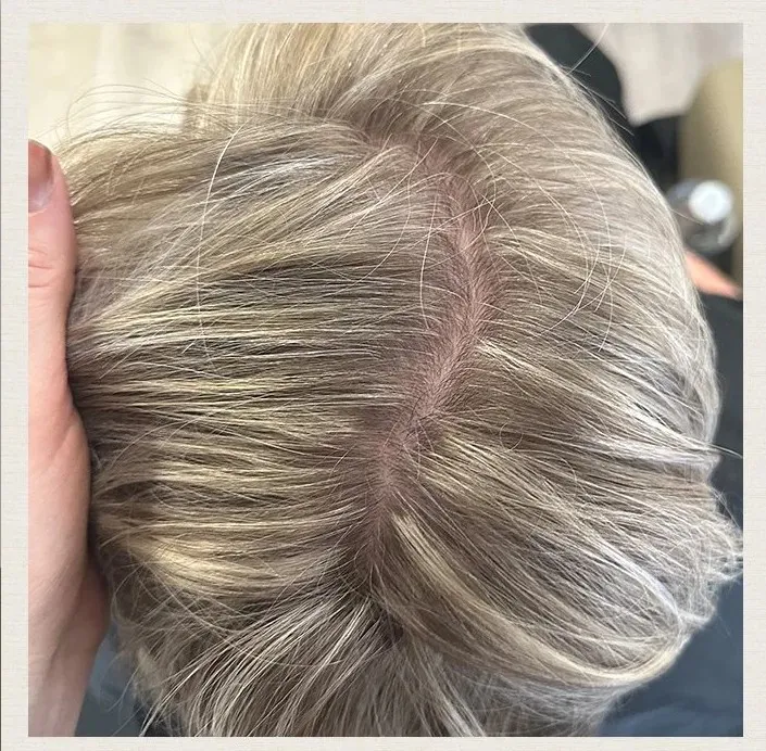 After 5 Months of treatment