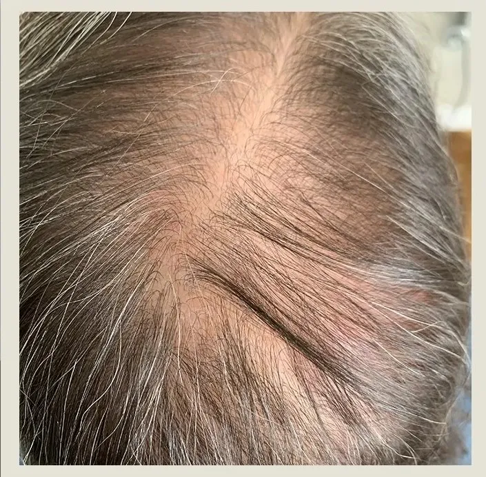 After 9 Months of treatment