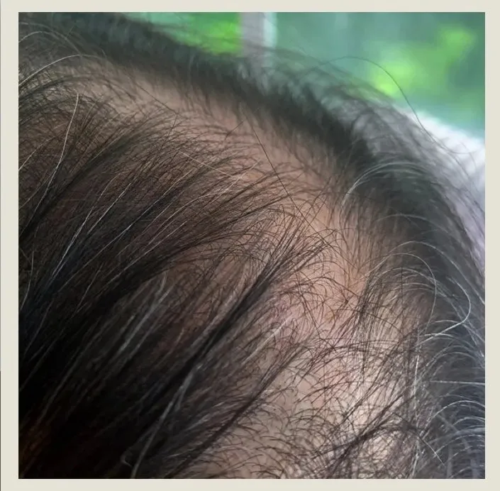 After 9 Months of treatment