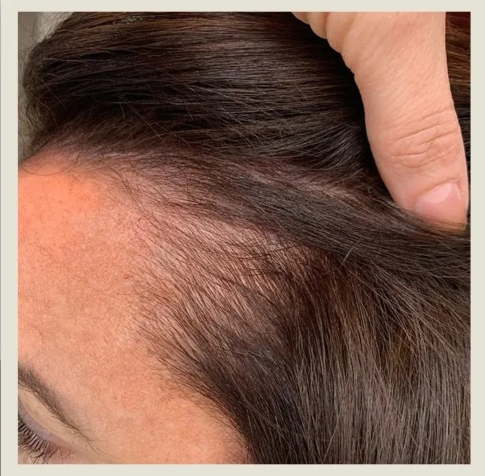 After 6 Months of treatment