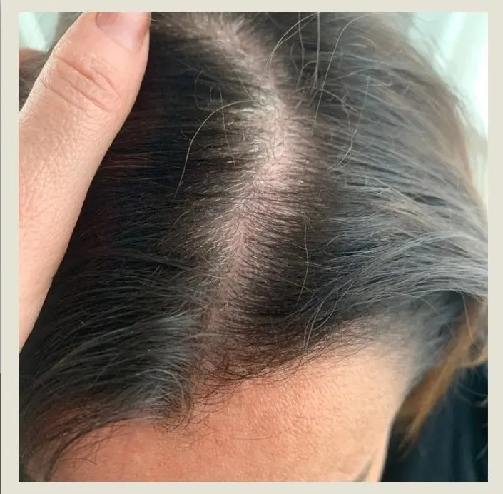 After 6 Months of treatment