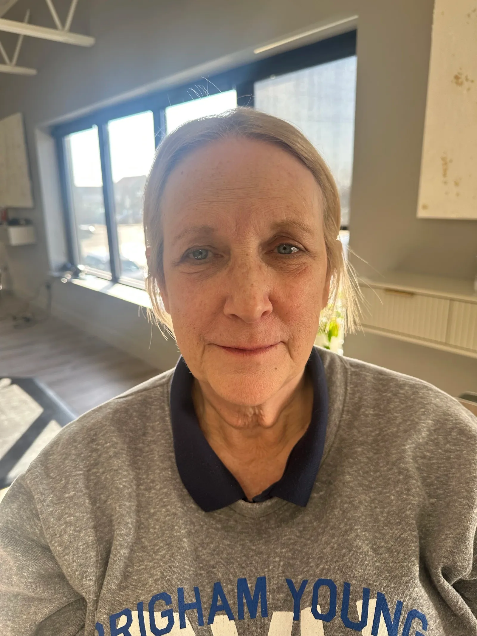 Before - Convenience