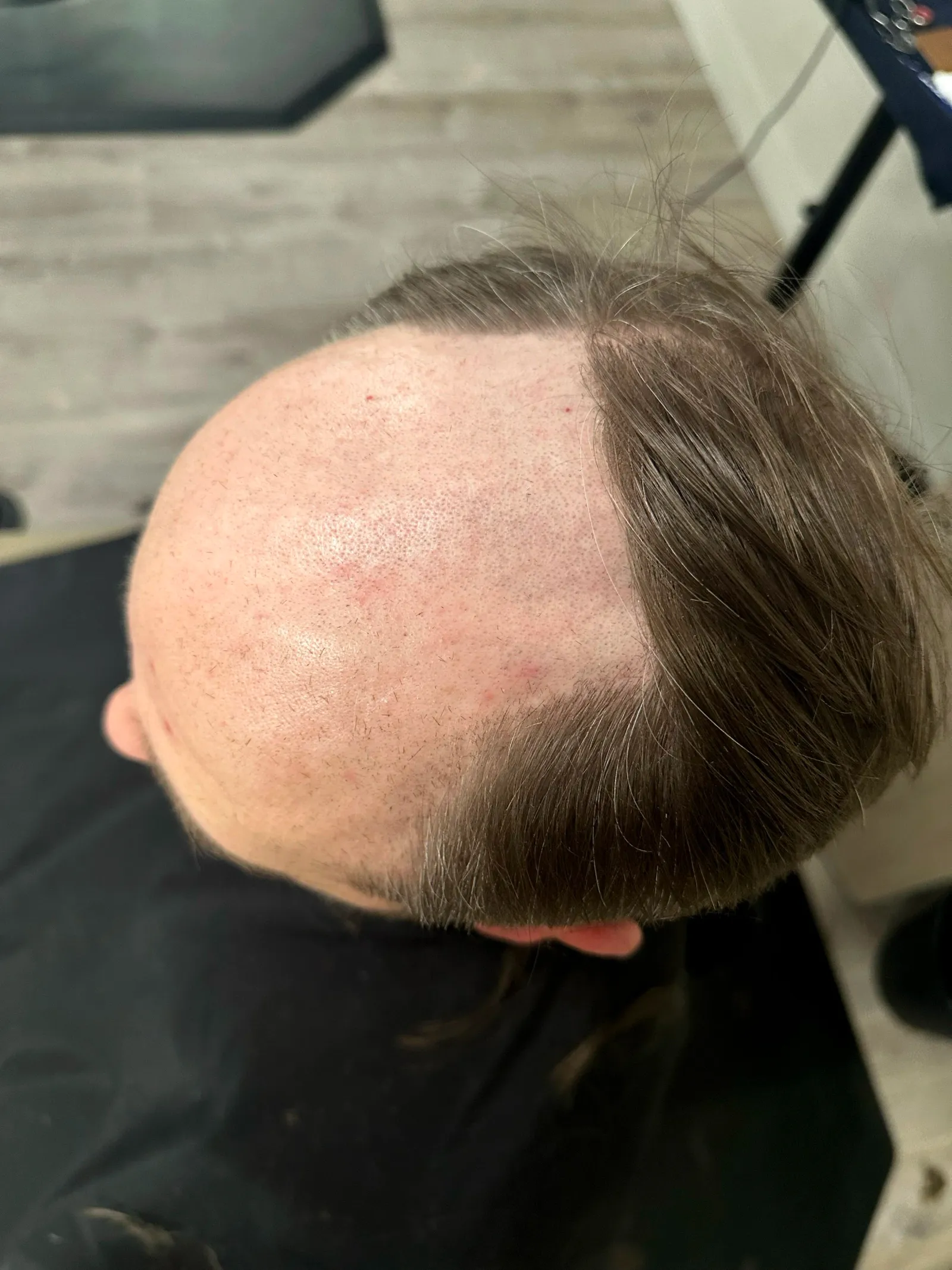 Client transformation 1 - before